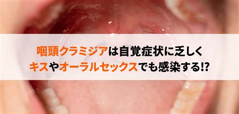 クラミジア フェラ|男性がフェラチオをされた場合に感染する性病と症状